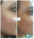 Best Skin Treatments Clinic in Greater Kailash
