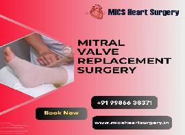 Mics Heart Surgery