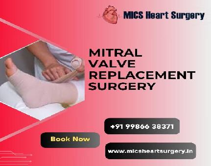 Mics Heart Surgery