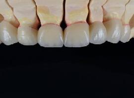 Dental Lab Equipment Supp..