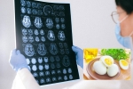 Eggs and Alzheimer’s for health, Eggs and Alzheimer’s food, eggs may help prevent alzheimer s study, Animal