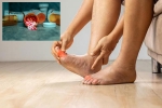 Gout Drugs vs Heart attack, Gout Drugs news, gout drugs may cut the risk of heart attack, Puri Gout Drugs vs Heart attack, Gout Drugs news, gout drugs may cut the risk of heart attack, Puri