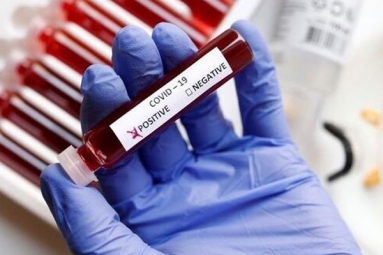 Hyderabad Reports A Surge In Covid-19 Cases Overnight