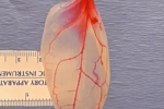 Patch For Diseased Hearts Using Spinach Leaves, WPI Scientists Develop Patch For Diseased Hearts, patch for diseased hearts using spinach leaves, Parsley