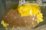 Universal Kidney latest update, Universal Kidney new updates, scientists develop universal kidney transplanted to any blood group, Kidney transplants