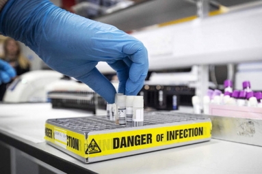 Novel coronavirus can withstand sustained exposure to heat: Study
