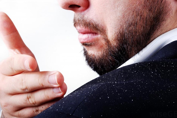 Home remedies to treat dandruff},{Home remedies to treat dandruff