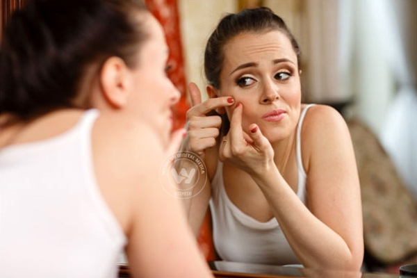 Home remedies for pimples },{Home remedies for pimples 